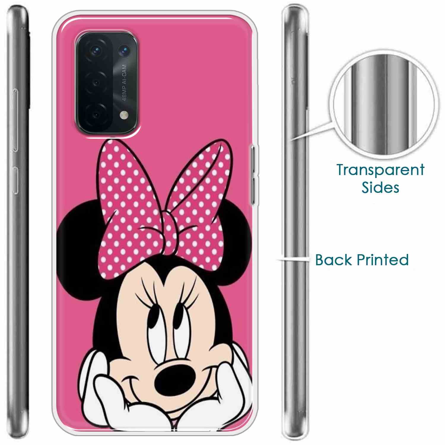 TPUOppoA545G-Minnie-2